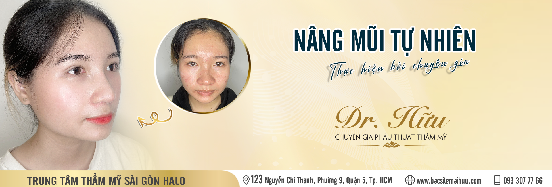 Chuyên gia thẩm mỹ - Dr Lê Mai Hữu - nâng mũi đẹp tự nhiên